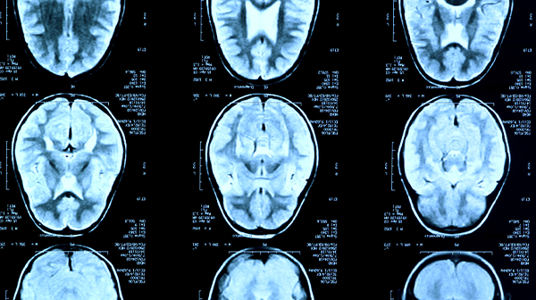 Màster Universitari en Enginyeria Biomèdica